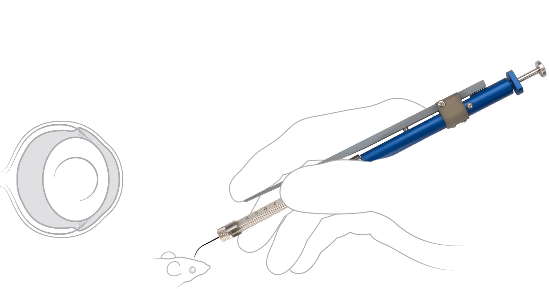 Use of Hamilton Intraocular Syringe